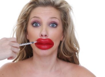 Cosmetic surgery-lip surgery