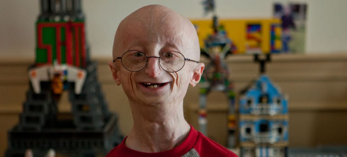 Knowing Progeria, an aging disease caused by gene mutation