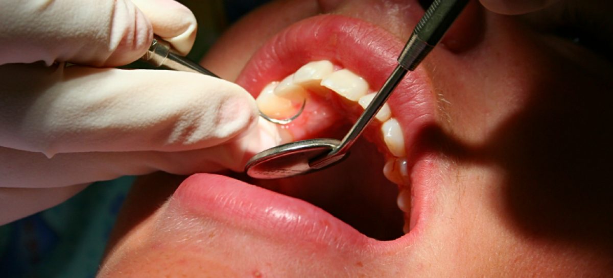 Dental cleaning is an important part of tooth maintenance