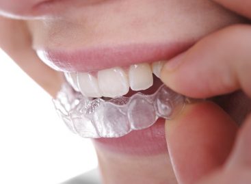 All about orthodontics invisalign