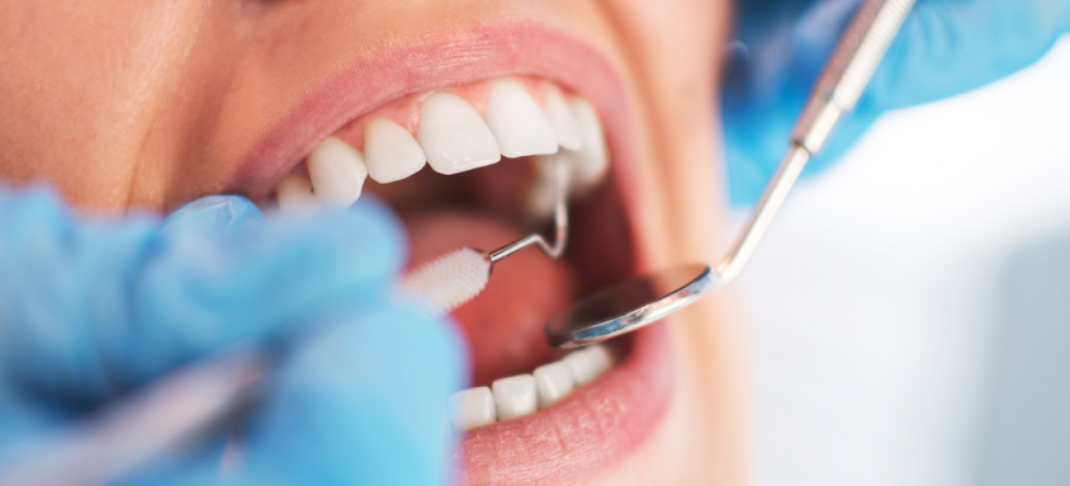 4 Reasons You Should Make Dental Health a Priority