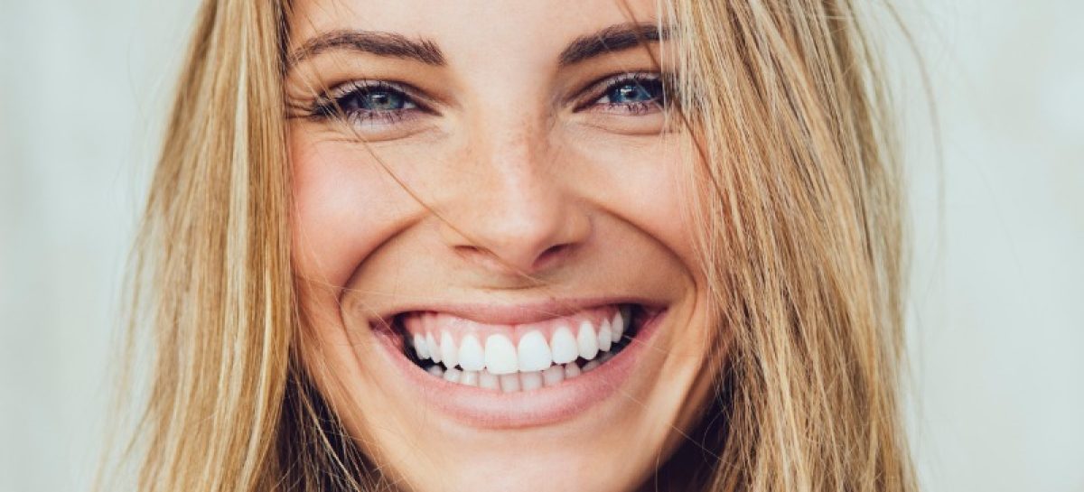 How to Feel More Confident When You Smile