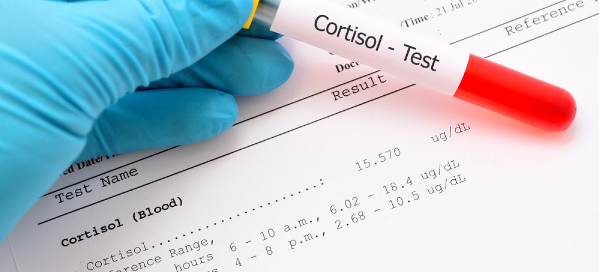 Reasons to Take an at-Home Saliva Cortisol Test